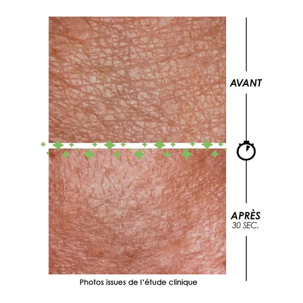 Garancia Pschitt magique Nouvelle peau