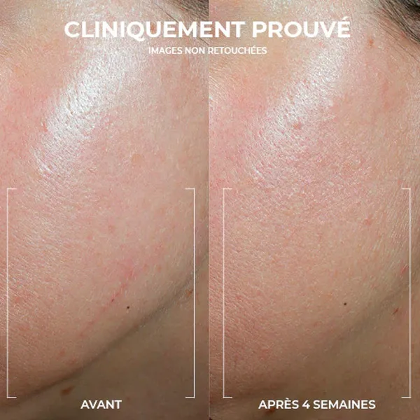 Roc Derm Correxion Crème contour Rétinol Avancé