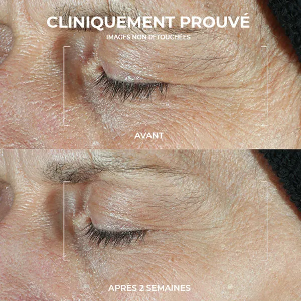 Roc Derm Correxion Soin Duo Contour des yeux
