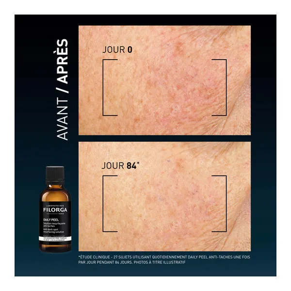 Filorga Daily Peel Solution resurfaçante anti taches