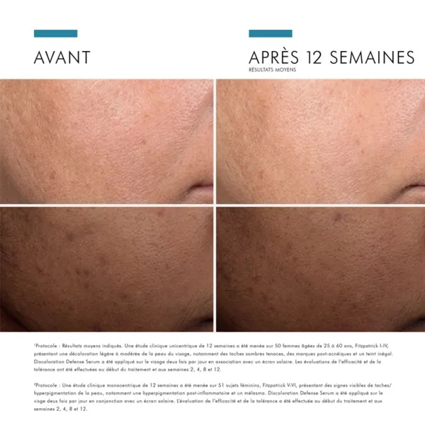 SkinCeuticals Discoloration Defense Serum