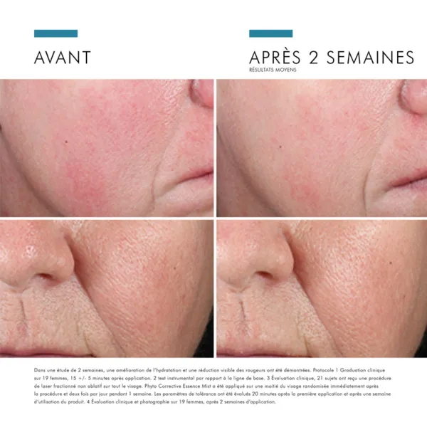 SkinCeuticals Phyto Corrective Essence Mist