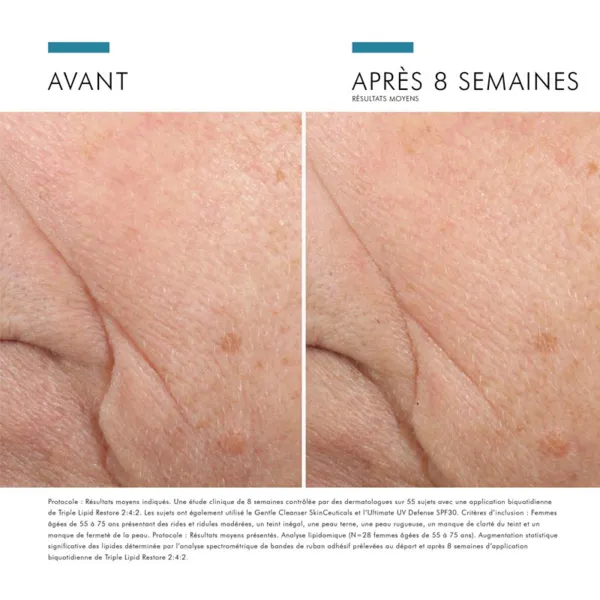 SkinCeuticals Triple Lipid Restore 2:4:2