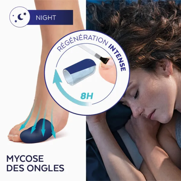 Poderm traitement intensif nuit mycose des ongles