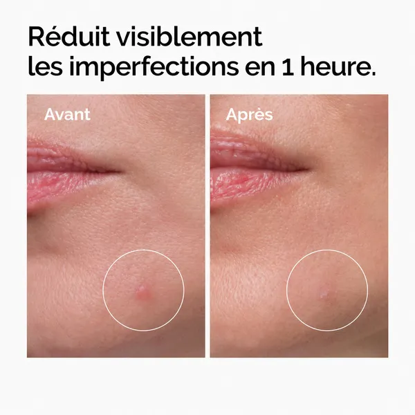 The Ordinary Concentré Crème en poudre de soufre 10%