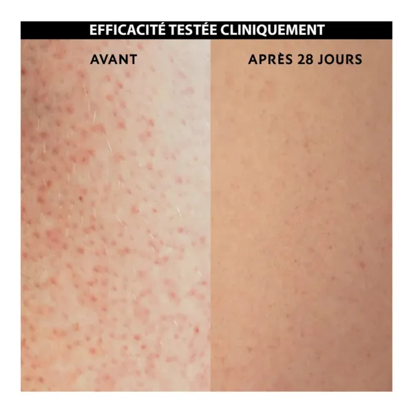 Alvadiem Keratolia+ Fluide corps anti-rugosités