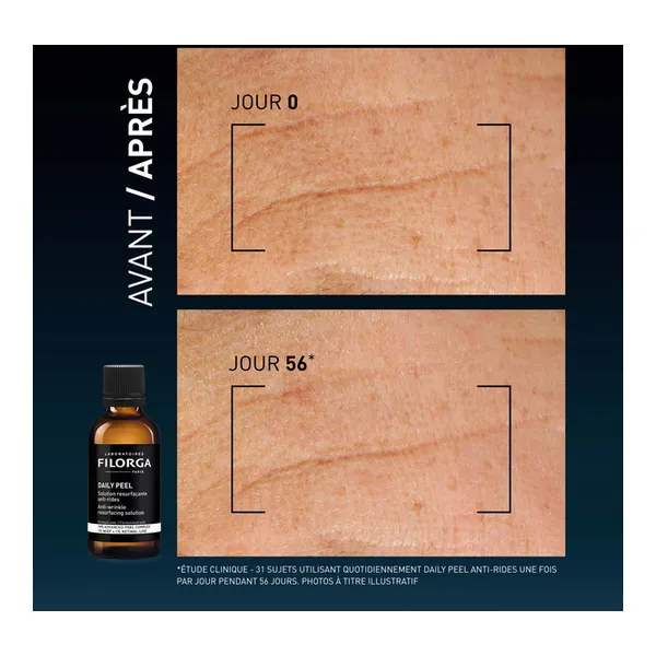 Filorga Daily Peel Solution resurfaçante anti rides
