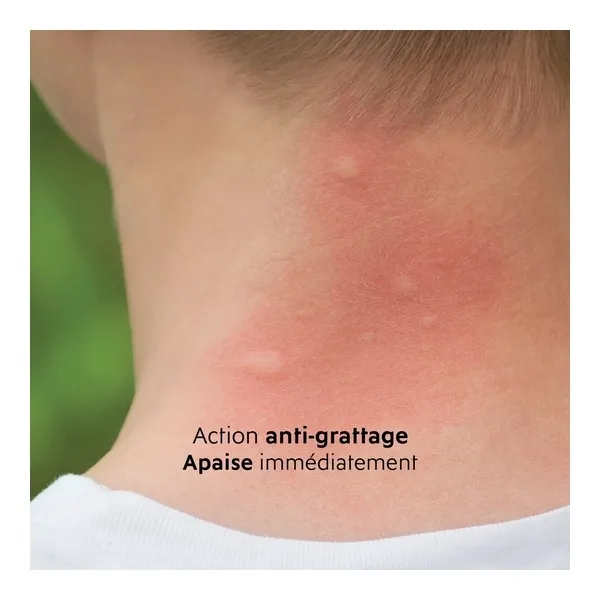 Alvadiem Gel apaisant piqures