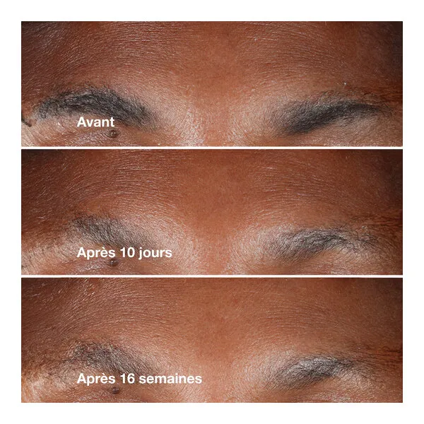 Clinique Smart clinical repair Sérum correcteur anti rides