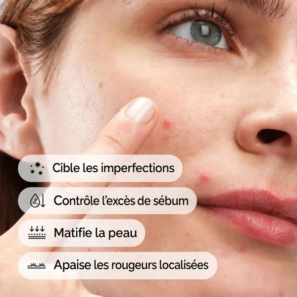 The Ordinary Concentré Crème en poudre de soufre 10%