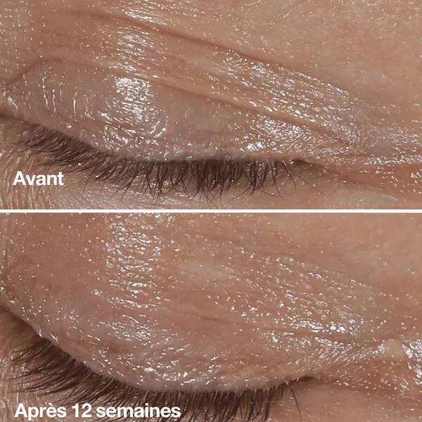 Clinique Smart Clinical Crème yeux correction rides