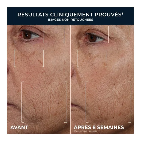 Roc Retinol Correxion Lissant rides Triple sérum