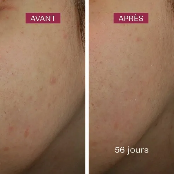 Biarritz Sérum anti taches