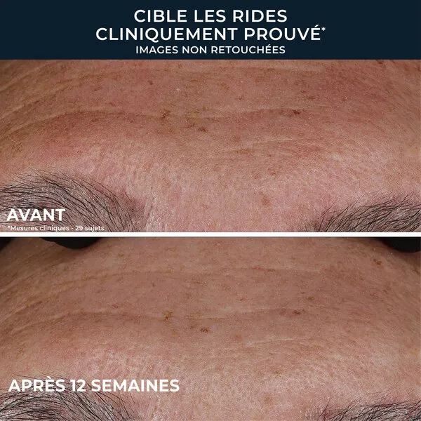 Roc Retinol Correxion Sérum correction rides