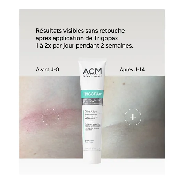 Trigopax crème
