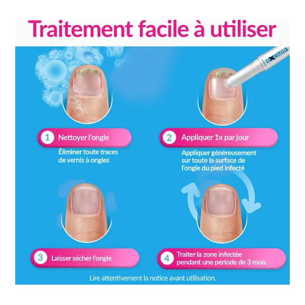 Excilor Easy mycose ongle stylet