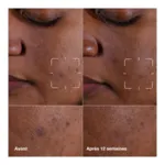Clinique even better clinical sérum illuminateur anti taches