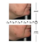 Garancia Étoile du Jour Crème Riche Rose Suprême Volumatrice Meno-Expert