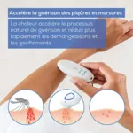 Beurer BR10 Appareil soulageant les piqûres d’insectes