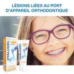 Hyalugel Ado gel buccal