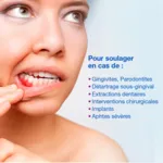 Hyalugel Forte Perio Gel buccal assainissant