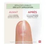 Poderm Nail corrector vernis amer