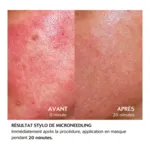 Cebelia Soin extrême apaisant