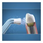 Embout pour hydropulseur Waterpik