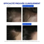 Phytophanère Antichute réactionnelle ampoule