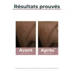 Eucerin Anti Pigment correcteur de taches