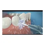 Embout pour hydropulseur Waterpik
