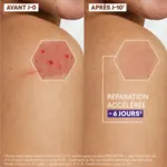 A Derma Epitheliale Ultra Repair crème réparatrice anti marques