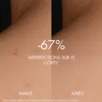 Biotherm biocorps sérum corps peeling peau neuve