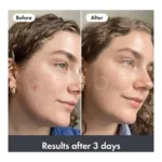 Hero Baume hydratant réparateur post imperfections