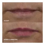 RoC Derm correxion lip volumizer soin volumateur lèvres