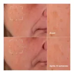 Clinique even better clinical sérum illuminateur anti taches