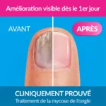 Excilor Forte solution filmogène