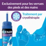 Excilor Verrue traitement par cryothérapie