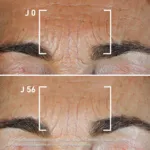 Filorga Global Repair Advanced Elixir intensif jeunesse