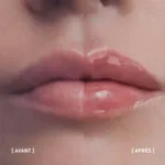 Filorga Hyalu-Filler lips soin lèvres volumateur