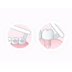 Gum End-Tuft brosse à dents souple