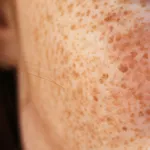 Cytolnat Kojic Crème éclat anti-taches