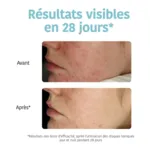Iroha Nature disques exfoliants anti imperfections