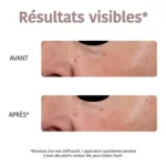 Iroha Nature Patch yeux anti âge