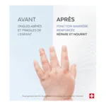 Poderm Ongles abîmés sérum kids