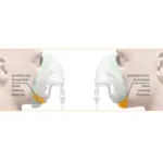 Cirrus 2 Kit nébuliseur masque