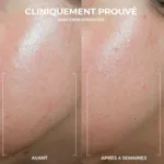 Roc Derm Correxion Crème contour Rétinol Avancé