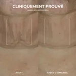 RoC Derm Correxion sérum raffermissant en stick