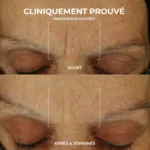 Roc Retinol Correxion soin lissant crème hydratation maximale