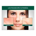 Deruba crème anti-rougeurs SPF 50+